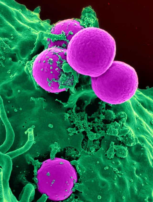 Small human cells